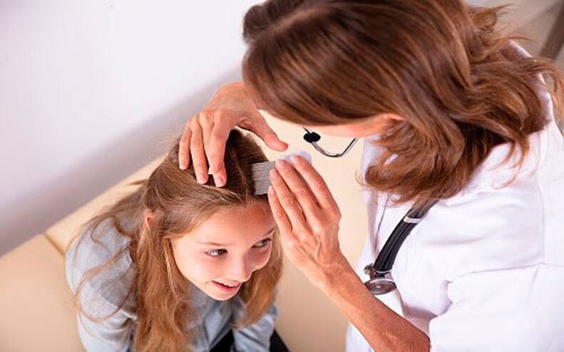 tratamento da psoríase da cabeça em crianças